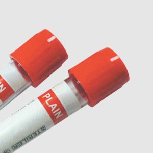 serum test tubes